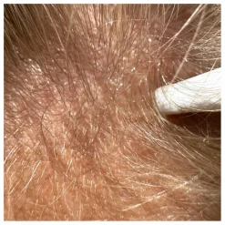 Hot Serum cheveux - Pure Growth - 100 ml Soins Grossesse/Maternité