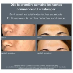 Hot Serum powerbright anti-tâches - 30ml Homme/Femme Soins Du Visage|Soins, Wellness