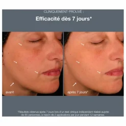 Homme/Femme Dermalogica Soins Du Visage|Soins, Wellness*Serum pro-collagen banking - 30ml